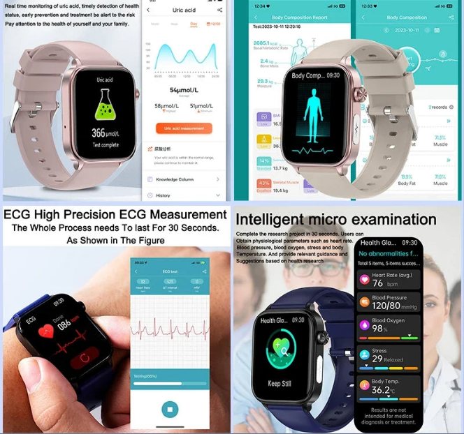 2025 New ECG+PPG Monitoring Smart Watch Women Blood pressure Blood Lipid Uric Acid Women Menstrual Health Tracker Smartwatches